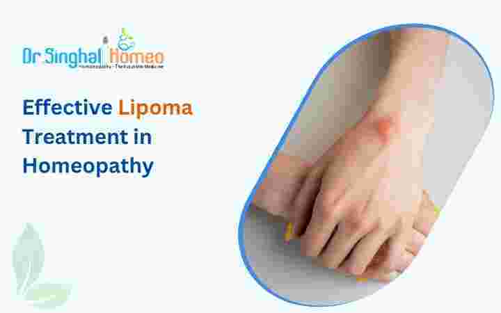 Finding the Best Homeopathic Doctor & Treatment in India: Your Guide to Trusted Healthcare  | Differ