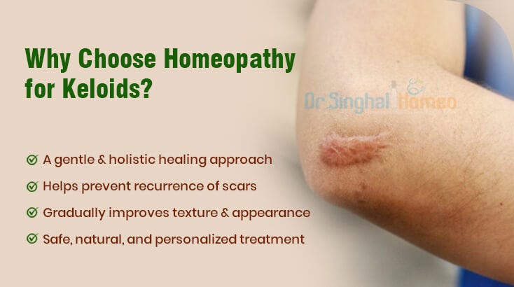 Natural Healing: Gentle Homeopathic Remedies for Keloids That Actually Work | by Dr. Singhal Homeo | Oct, 2025 | Medium