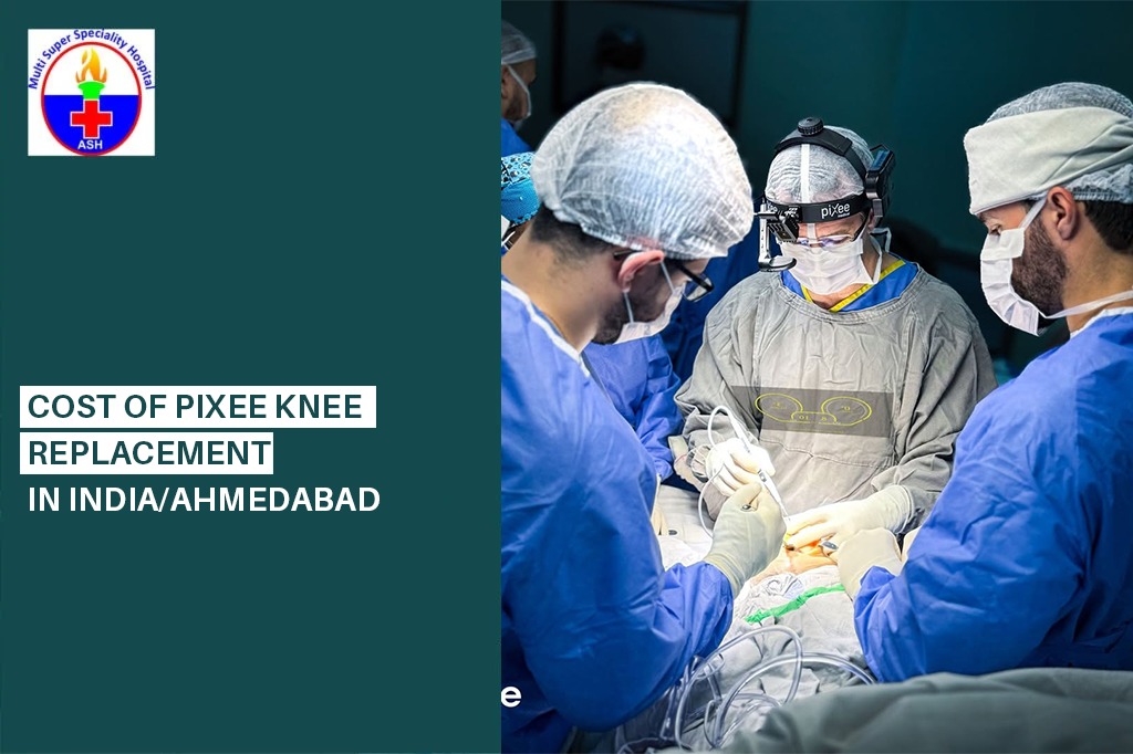 Cost of Pixee Knee Replacement in India/Ahmedabad