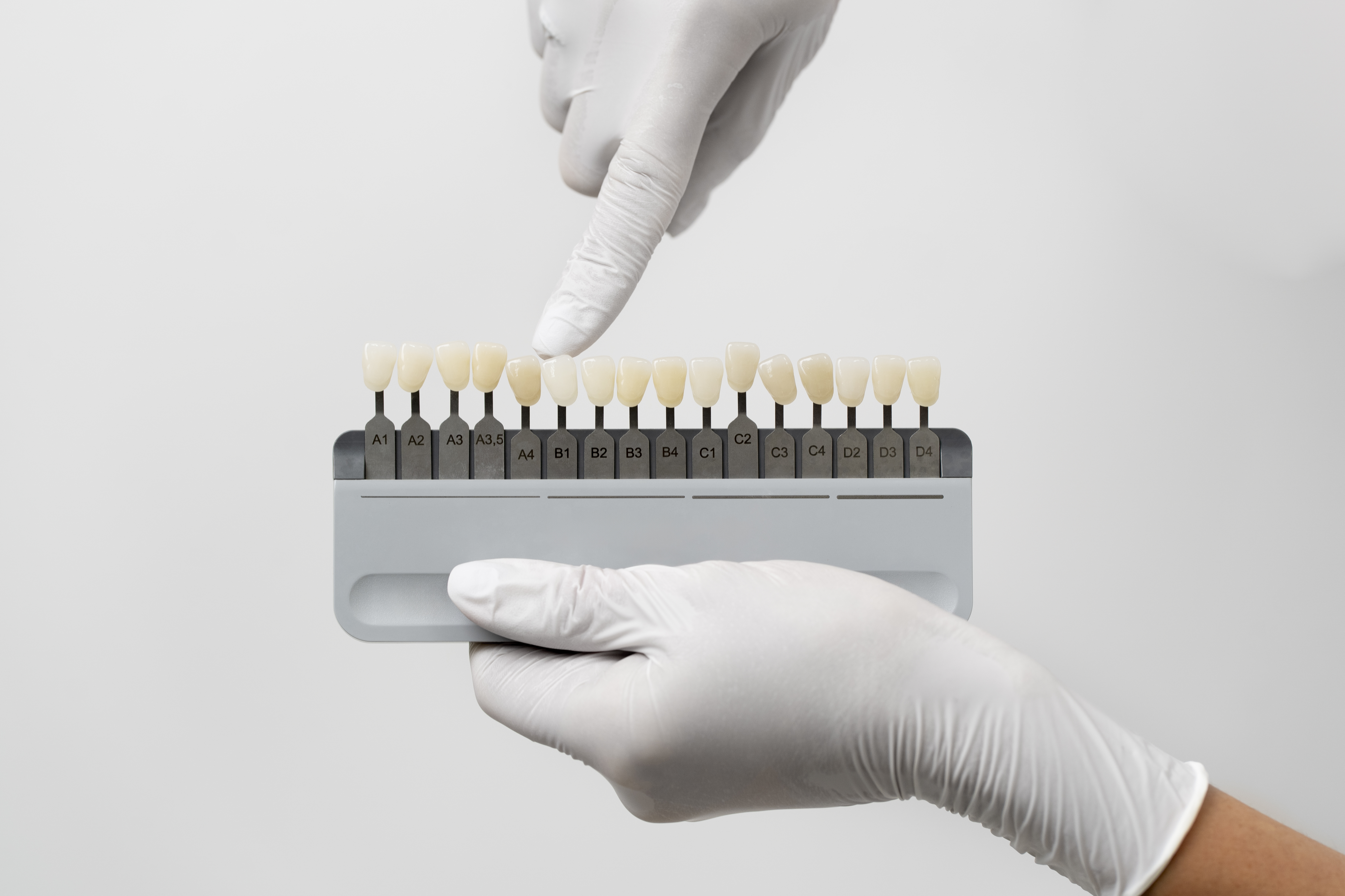 How Dental Porcelain Has Revolutionised Aesthetic Dentistry in India – Shofu Dental India