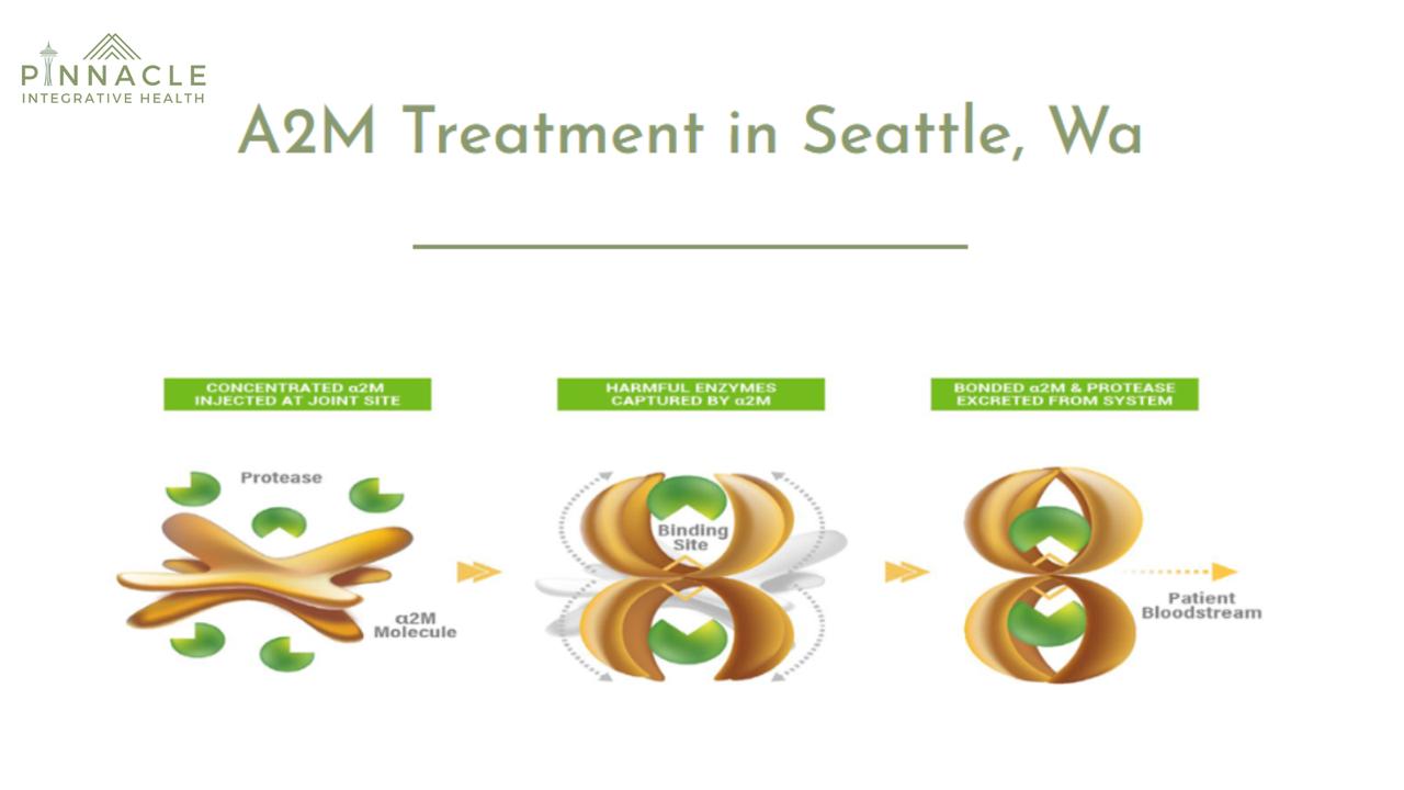 Effective A2M Therapy for Joint Pain Relief Solutions | Articles | Pinnacle Integrative Health | Gan Jing World - Technology for Humanity | Video & Movie Streaming