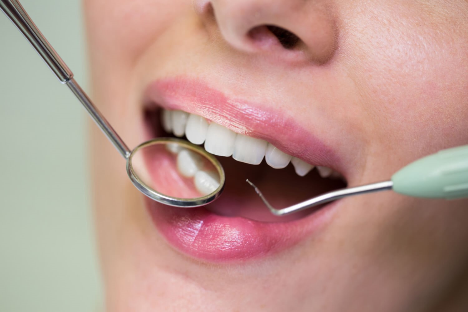 Full Mouth Restoration and Procedures Guide for 2025