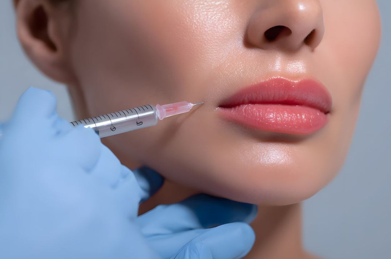 Why More Women Choose Lipfillers For A Natural Enhancement Of Their Lip Shape