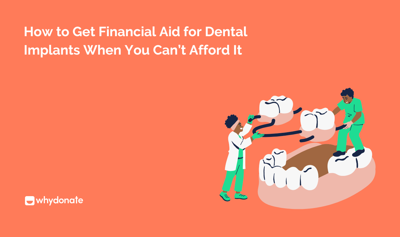 How To Get Dental Implant Financial Aid | Affordable Options