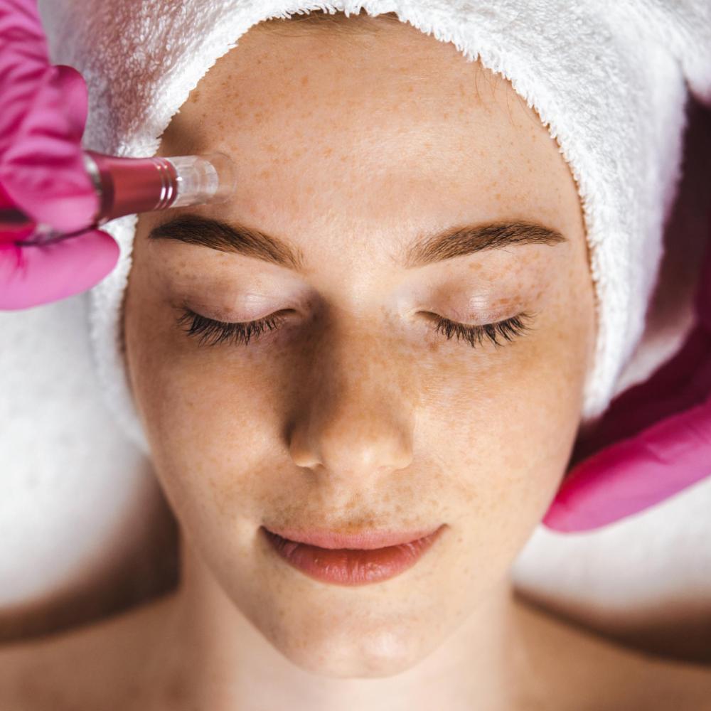 Microneedling Clinic Bloomingdale | Skin Care