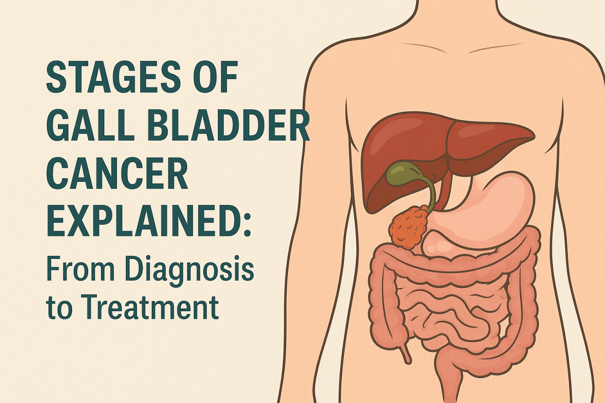 Stages of Gall Bladder Cancer Explained: From Diagnosis to Treatment – Action Cancer Hospital