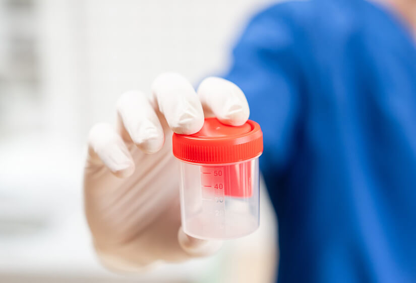 Where to Get a Semen Analysis in Delhi? Dr Rhythm Gupta