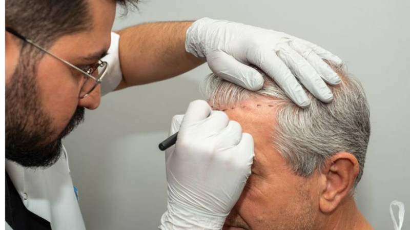 New Year, New You: Here’s What to Know Before Getting a Hair Transplant in Pakistan: emmacarter78 — LiveJournal