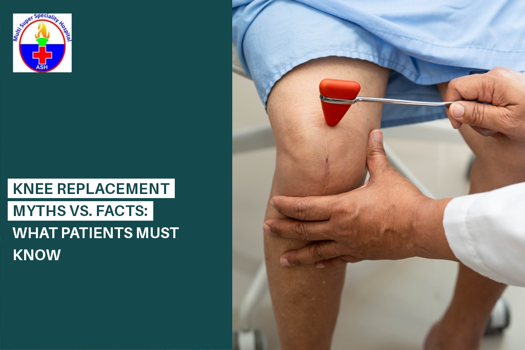 Knee Replacement Myths vs. Facts: What Patients Must Know