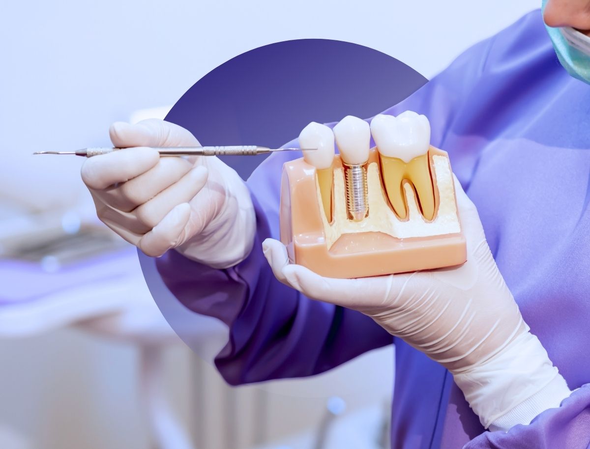 Dental Implant Treatment in Mysore