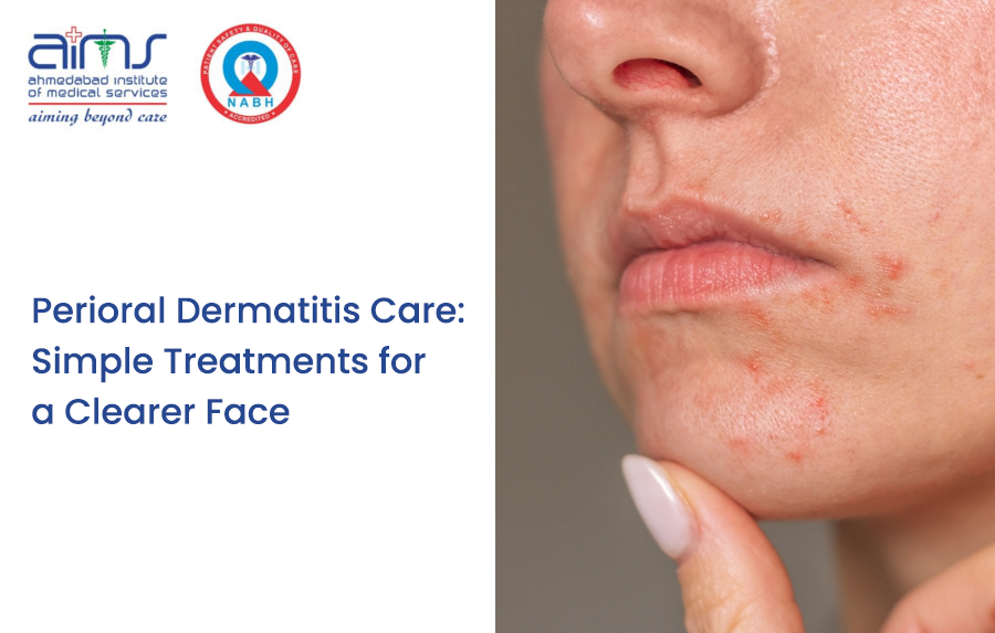 Perioral Dermatitis Care: Simple Treatments for a Clearer Face