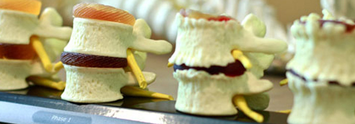 New Rochelle Chiropractor Talks about Bulging Discs