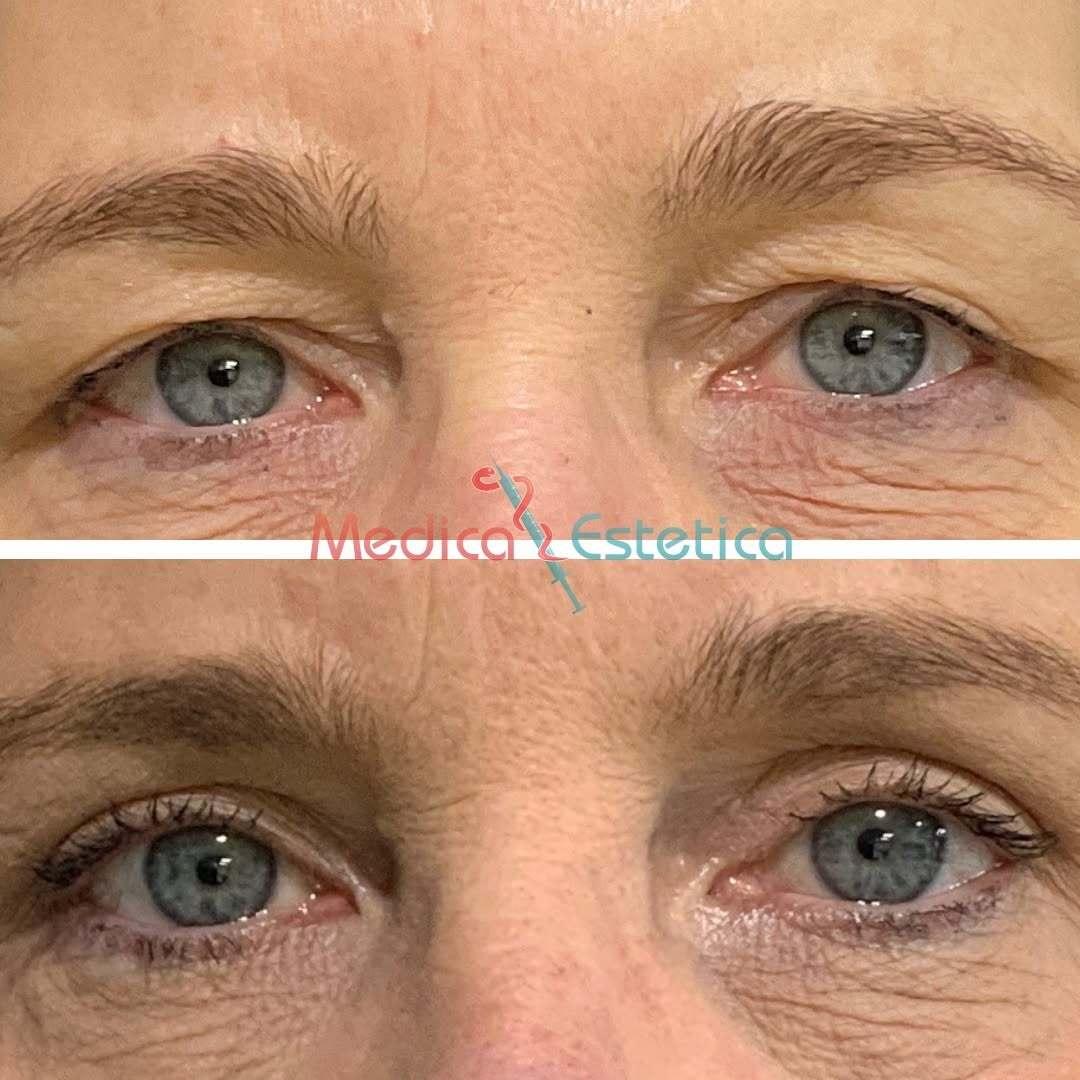 How 2026 Plasma Energy Treatments Are Helping People Get a...