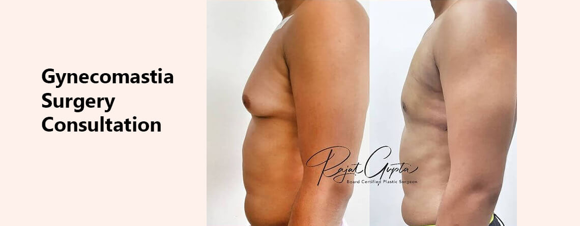 Gynecomastia Surgery Consultation Online? Dr Rajat Gupta