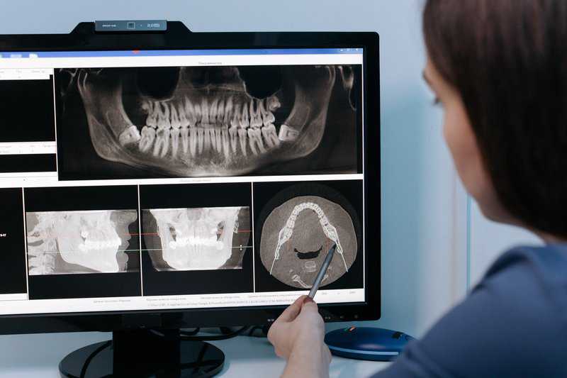 How 3D Digital Dental Impressions are Elevating Dental Care - Oral Health - Mt. Pleasant Dentist - Kari Ryan