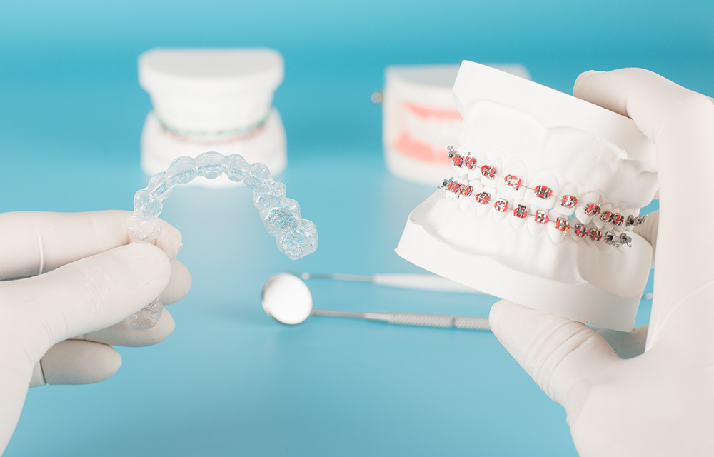 Invisalign Treatment vs Braces | Expert Dentist in Ahmedabad Explains