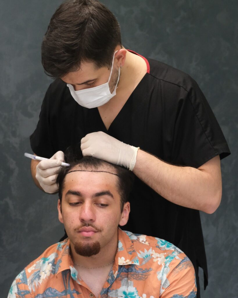 Best Sapphire FUE Hair Transplant Turkey - UniquEra Clinic