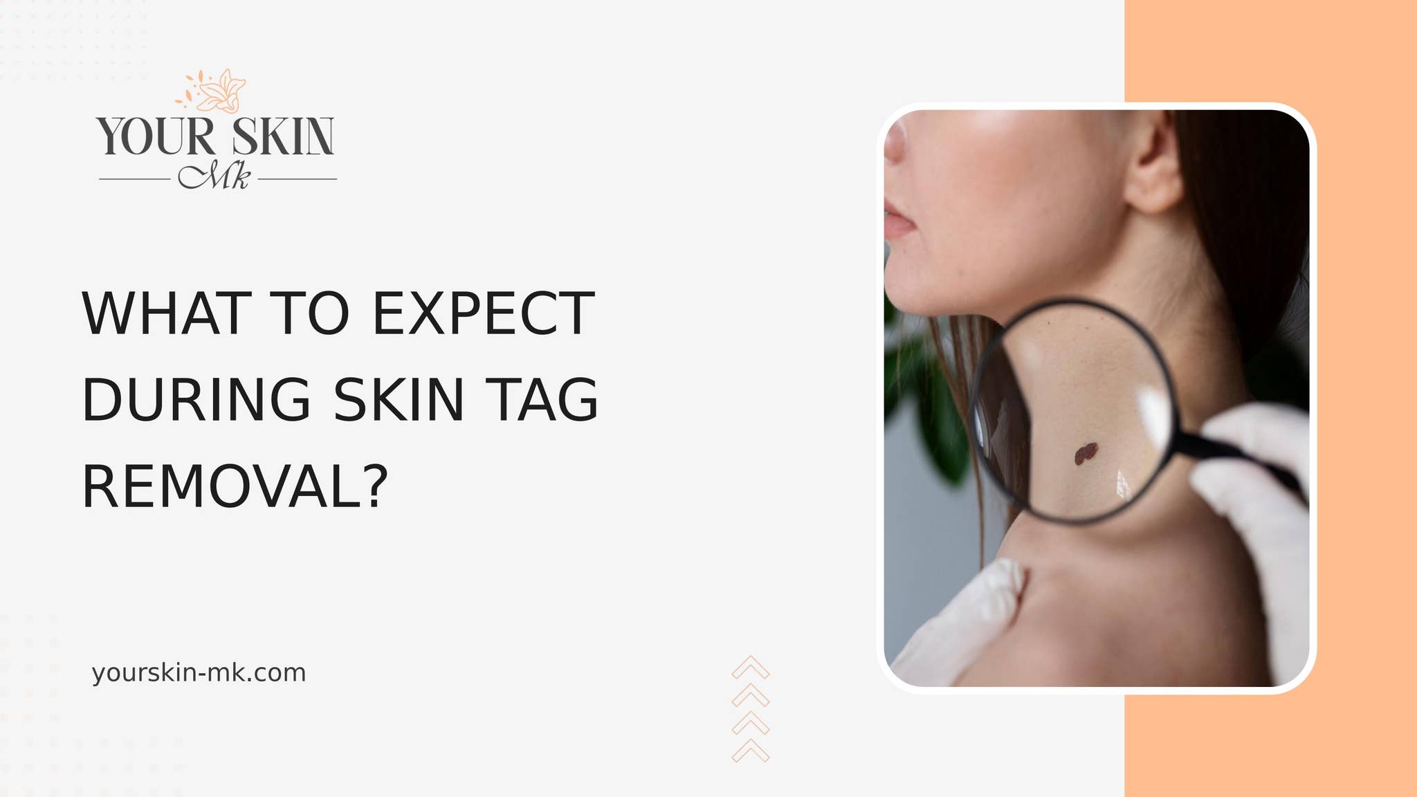 What to Expect During Skin Tag Removal by Yourskin Mk - Issuu