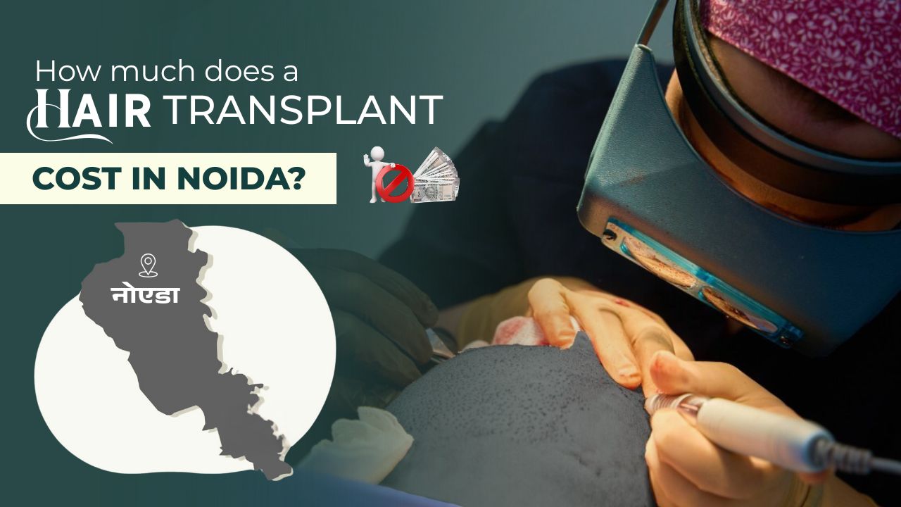 Hair Transplant Cost in Noida | Best Hair Transplant Clinic  Doctor